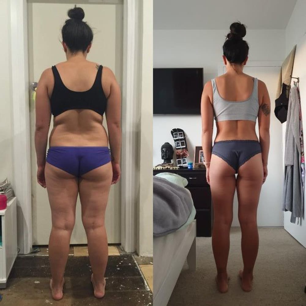 Antes e depois do Protocolo Bumbum Bonito